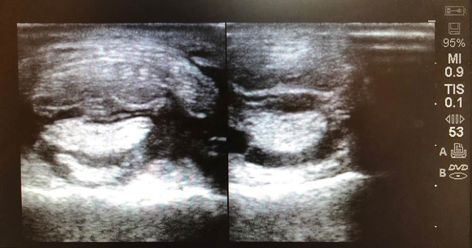 Digital Ultrasound