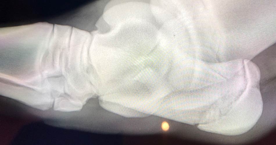 Digital X-ray